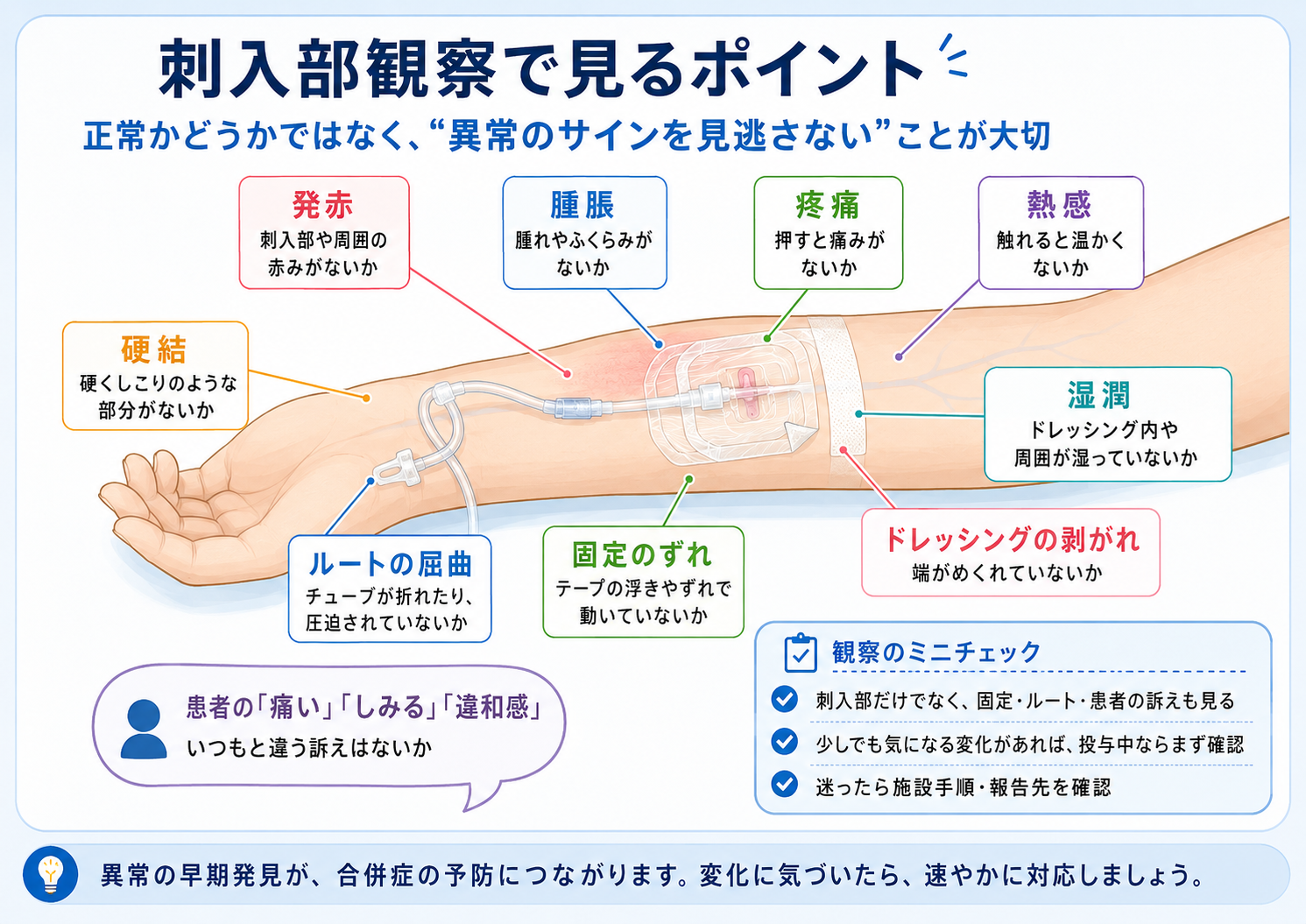 刺入部観察で見るポイント：発赤（刺入部や周囲の赤みがないか）／腫脹（腫れやふくらみがないか）／疼痛（押すと痛みや安静時痛がないか）／熱感（触れると温かいか）／硬結（硬くしこりのような部分がないか）／湿潤（ドレッシング内や周囲が湿っていないか）／ドレッシングの剥がれ（端が浮いていないか）／固定のずれ（カテーテルが動いていないか）／ルートの屈曲（チューブが折れたり圧迫されたりしていないか）／患者の「痛い」「しみる」「違和感」を軽く扱わない。異常の早期発見が合併症の予防につながる